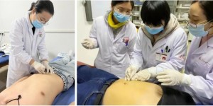 甩掉赘肉正逢时！合江县中医医院招募肥胖患者，欲报从速！