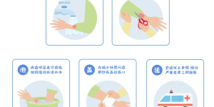 意外！煮沸的鸡汤被打翻，泸州嬢嬢遭烫伤后……