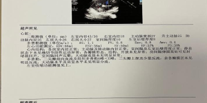 合江县人民医院成功开展全县首例先心病微创介入封堵治疗术