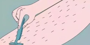 天气热了，女生能脱下面的毛毛吗？泸州妇科医生说……