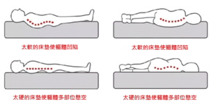 明明是腿痛腿麻，为什么偏说是腰椎出了问题？