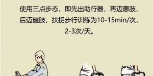 78岁股骨折老人，术后3天就下地行走！泸州这家医院骨科“王炸”团队太牛了！