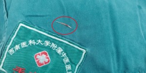 惊险！泸州大爷一个月前误吞鱼刺，竟被切开脖子……