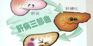 西南医大附属医院乙肝临床治愈门诊开诊！