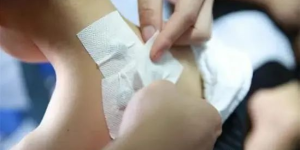 热不可耐，趁热打“贴”丨西南医大附院“三伏贴”开贴啦……