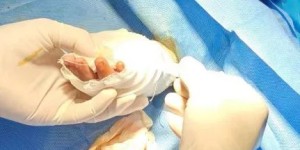 【警示】2岁小女孩被宠物狗连咬几口，泸州急诊医生发来这份提醒→