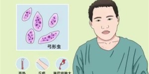 泸州一男子感染寄生虫！竟可导致胎儿畸形！