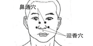 近期高发，很多人中招！医生提醒：严重真会要人命