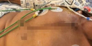 泸州一男子坐自家窗边玩耍遭枪击受重伤，官方：4人用气枪打鸟误伤人，已抓获