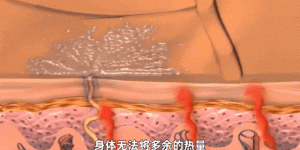 高温警报！中暑不是小毛病，这些知识必须刻进DNA！！！
